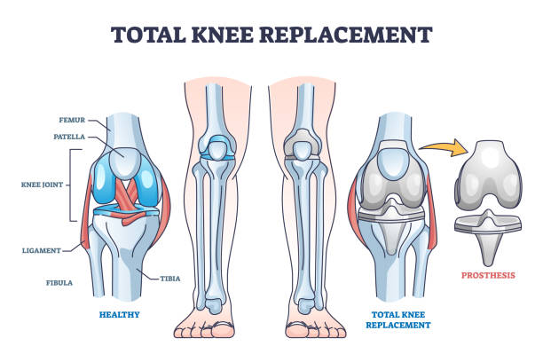 Best Total Knee Replacement Surgeon In Mulund-2